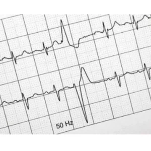 Papel Electro 110 × 140 × 140 – Papel Térmico de Alta Sensibilidad